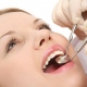 Getting Quality Dental Treatment Without Constraint About Money